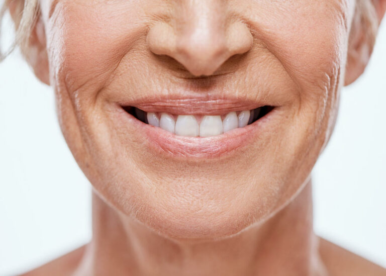 Ältere Frau mit schönen Zähnen